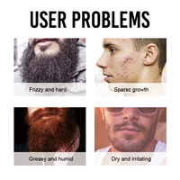 Marque privée NOUVEAUTÉS Produits de soins personnels pour hommes Huile de croissance pour la barbe Huile lissante pour la barbe 30ml