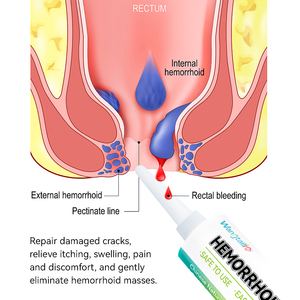 ครีมสมุนไพรบรรเทาอาการริดสีดวงทวาร |   วังไทลิน ซูทติ้ง แคร์ สำหรับ<span class=keywords><strong>อาการ</strong></span>คันที่ทวารหนัก <span class=keywords><strong>ปวด</strong></span> และรอยแยก 20 กรัม - Product Image 4