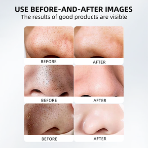 Masker Pori-pori Hidung Organik Bebas Pewangi Vegan Berkualitas Tinggi Penghilang Komedo Perawatan Jerawat Pembersih Pori-pori Pengelupas Pori-pori - Product Image 6