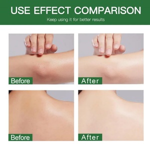 Ventes d'usine, crème hydratante pour le corps 300g, soin de la peau, éclaircit le teint, niacinamide, hydratant - Product Image 6