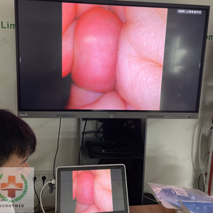 SY-P029-3 Veterinary Video Flexible Endoscope HD 2.8 mm Diameter for Small Animals Diagnosis - Product Image 5