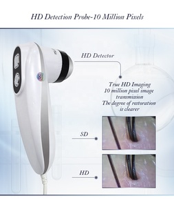 15.5 Inch HD Display With 2 Detector Portable Scalp Dandruff Damaged Skin Analysis Hair Machine Scalp Camera 32GB RAM - Product Image 4