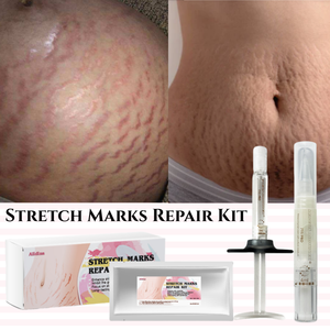 G Striae Verwijderingscrème Body Vermindert Litteken Uiterlijk Zachte Striae Uitroeiing Verstevigende Striae Reparatie Kit - Product Image 1