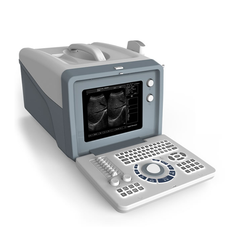 MN-S218 Clinic medical portable black and white ultrasound machine for patient diagnosis use
