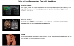Sonoscape P20 Maquinas De Ultrasonido Medico <span class=keywords><strong>3d</strong></span> <span class=keywords><strong>4d</strong></span> 5d Ultrasone Kleur <span class=keywords><strong>Doppler</strong></span> - Product Image 4