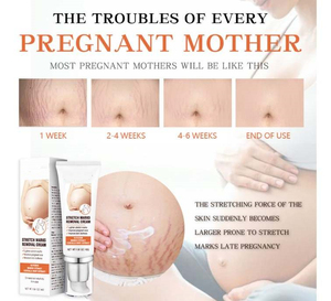 <span class=keywords><strong>Meilleure</strong></span> vente en gros crème réparatrice <span class=keywords><strong>Anti</strong></span>-vergetures à base de plantes biologique, Gel efficace pour l'élimination des cicatrices profondes - Product Image 3