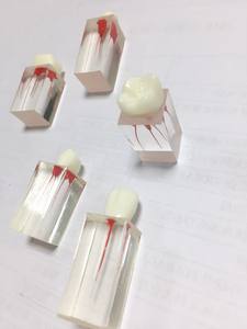 新型时尚树脂牙髓治疗模型中切牙根管手术演示5个阶段 - Product Image 5
