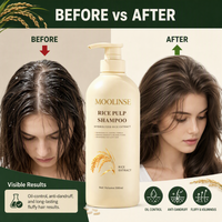 Supports personnalisés OEM ODM RTS – Shampoing et après-shampoing à la pulpe de riz 500 ml – Gel anti-démangeaisons et contrôle du sébum – Kit de soins capillaires pour adultes