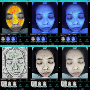 Analyseur de peau 3D Magic Mirror <span class=keywords><strong>Max</strong></span> 16MP avec imagerie spectrale RGB UV PL pour la gestion cloud et la beauté - Product Image 6