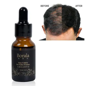 Borala Effectief Opnieuw Groeien Uw Haar Hergroei Serum Haarbouw Vezel Behandeling Verlies