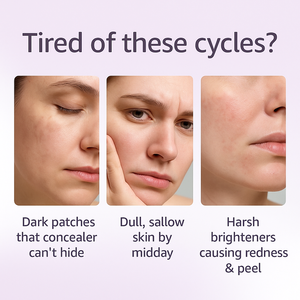 เซรั่มบำรุงผิวหน้าและลำคอสูตรไวท์เทนนิ่งและให้ความชุ่มชื้นสำหรับผิวแพ้ง่าย ไนอะซินาไมด์ 10% + ทีเอ็กซ์ที 4% สำหรับกลางคืน ขนาด 30 มล. - Product Image 5