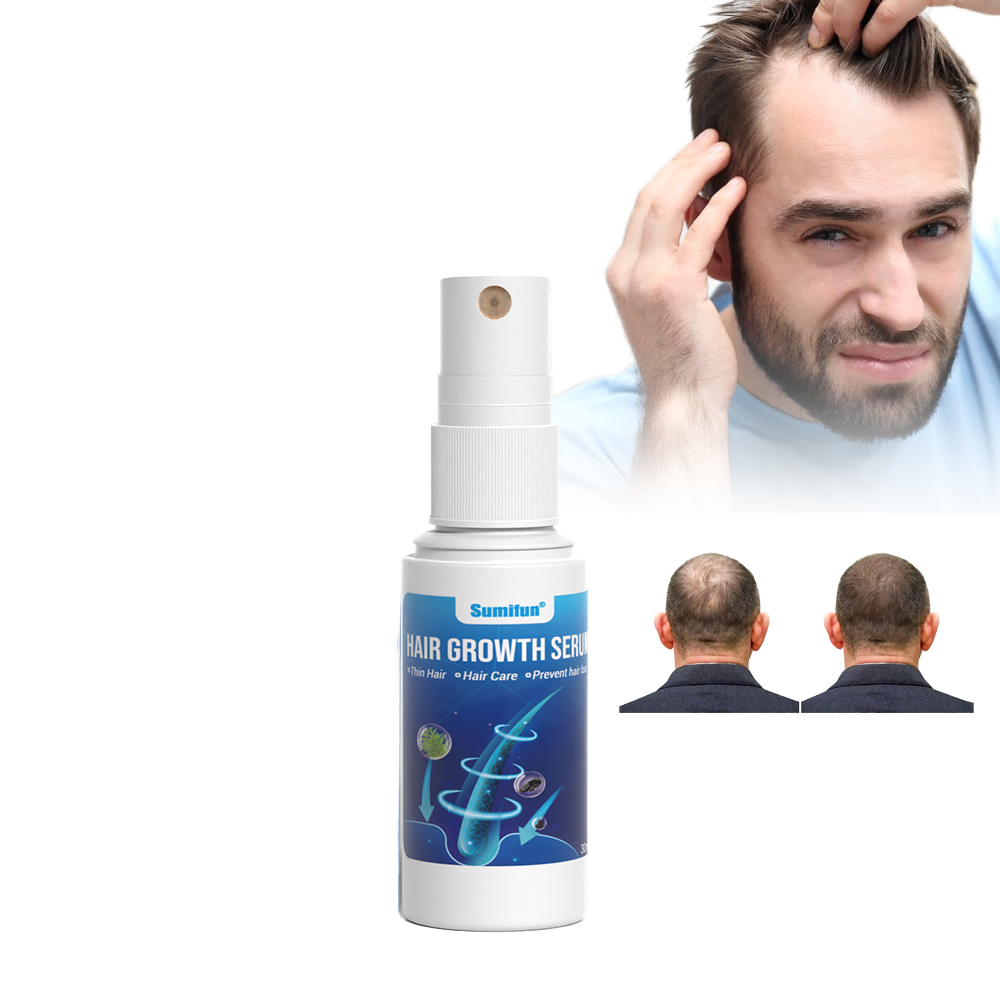 Private Label Sumifun Herbal Thicken Hair Growth & Regrowth Hair Care Spray