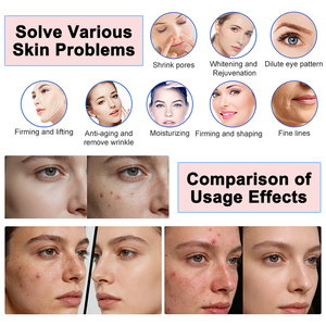 Appareil de beauté pour <span class=keywords><strong>spa</strong></span>, machine faciale de bureau, oxygénothérapie, équipement de beauté pour la réparation de la <span class=keywords><strong>barrière</strong></span> cutanée, hydratation profonde - Product Image 6