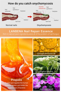 Sérum Réparateur d'Ongles <span class=keywords><strong>Anti</strong></span>-<span class=keywords><strong>Fongique</strong></span>, Élimine l'Onychomycose, Nourrissant et Éclaircissant pour les Soins des Mains, des Pieds et des Orteils - Product Image 4