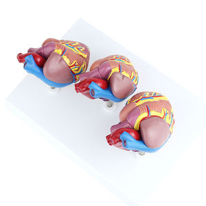 Model penyakit jantung medis 3 buah, Model anatomi jantung manusia ukuran alami, organ Sains jantung pendidikan - Product Image 5