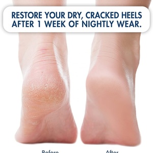 Calcetines Hidratantes con Gel para Talones Secos y Agrietados, Calcetines de Silicona para Spa, Ideales para el Dolor de Talones y Talones Secos y Agrietados - Product Image 2