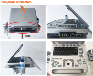 Ecografo الموجات فوق الصوتية الرقمية للقلب بالألوان دوبلر ثلاثي الأبعاد 4d صدى طبي للإنسان - Product Image 2