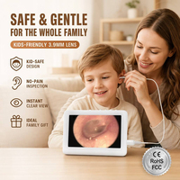 Offre Spéciale : Otoscope Numérique Mini HD 3,9 mm, Endoscope Auriculaire Vidéo LCD 4,5 pouces, Microscope Numérique, Cure-oreille Visuel