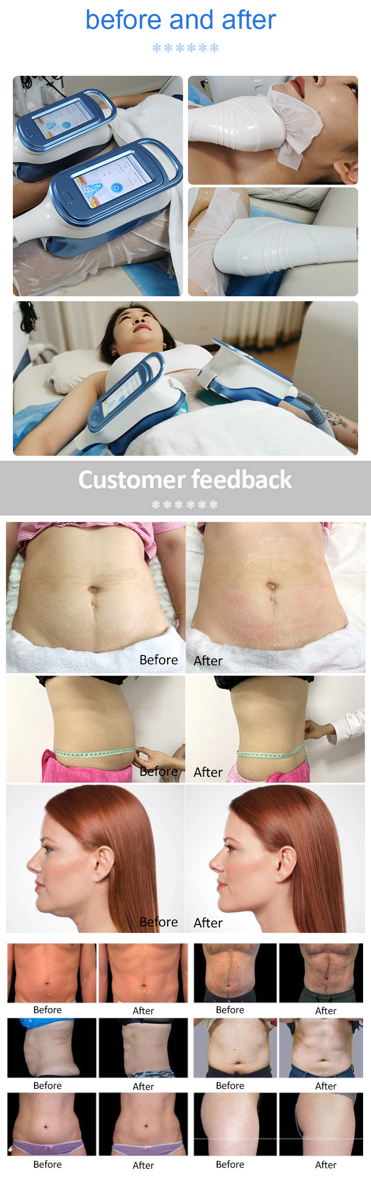 Cryo 360 Fat Freeze Machine Fat Freezing Rf Machine Face Body 360 Cryo 360 Cryo Slimming Machine