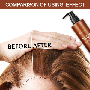 Campione Gratuito: Trattamento Anticaduta per <span class=keywords><strong>Uomo</strong></span>, Siero per la Crescita dei Capelli con Massaggio del Cuoio Capelluto, <span class=keywords><strong>Shampoo</strong></span> dalla Cina con Funzione Prevenzione Caduta Capelli - Product Image 4