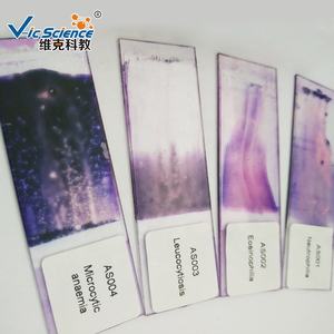 Lames d'hématologie, ensemble de lames préparées pour le <span class=keywords><strong>sang</strong></span>, lames préparées pour <span class=keywords><strong>microscope</strong></span> d'hématologie sanguine - Product Image 3