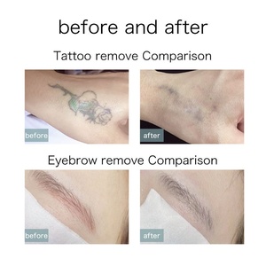 Appareil de beauté multifonctionnel pour le nettoyage en profondeur et l'éclaircissement de la peau, machine d'élimination des tatouages et de la mélanine - Product Image 5