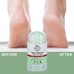 Krim Perawatan Kaki Shea Butter Pelembap untuk Kaki Kering dan Pecah-pecah - Product Image 1