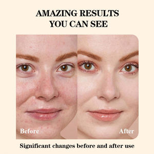 Probieren Sie natürlichen, nicht parfümierten Talg balsam mit Honig-Gesichts-und Körperpflege creme und Lotion - Product Image 5