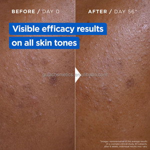<span class=keywords><strong>Crème</strong></span> au beurre de karité <span class=keywords><strong>Mixa</strong></span> Niacinamide Vitamine C Ultra Douce à l'Urée et au <span class=keywords><strong>Cica</strong></span> Réparatrice 400ml - Product Image 3