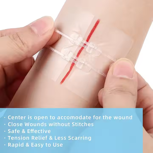 Dispositivo de cierre de piel de herida resistente a bacterias <span class=keywords><strong>con</strong></span> certificado CE médico desechable tiras transparentes sin costuras autoadhesivas estériles - Product Image 2