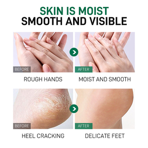 Crème hydratante personnalisée pour les <span class=keywords><strong>pieds</strong></span> baume réparateur professionnel pour les fissures crème pour <span class=keywords><strong>pieds</strong></span> en bâton pour les talons crevassés secs - Product Image 5