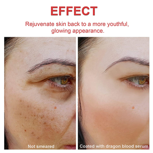 <span class=keywords><strong>Serum</strong></span> personalizado de cuidados com a pele, etiqueta privada anti-envelhecimento anti-rugas reduz cinco linhas de reparo da pele dragão soro de extrato de sangue - Product Image 2