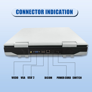 Mesin <span class=keywords><strong>Ultrasound</strong></span> medis, pemindai <span class=keywords><strong>Ultrasound</strong></span>/ultrasonografi diagnostik mesin <span class=keywords><strong>Ultrasound</strong></span> medis harga bagus - Product Image 4