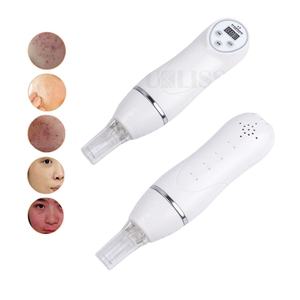 Dispositivo de Belleza para Limpieza Facial de Poros, Exfoliante de Piel, Mini Máquina Digital de Succión al Vacío para Eliminar Puntos Negros con Punta de Diamante - Product Image 1