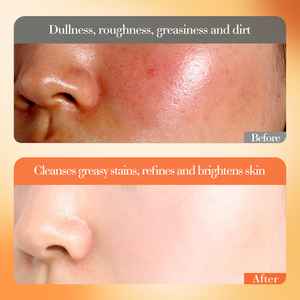 Set de 6 Productos para el Cuidado de la Piel con Vitamina C, Blanqueador, Limpiador Facial, Tónico, Suero, Crema para Ojos, Crema Facial Antienvejecimiento, Caja de Regalo - Product Image 4