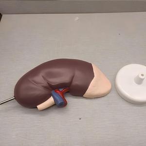 Modelo Anatómico de Riñón con Glándula Adrenal - Herramienta de Enseñanza de Nefrología Desmontable - Product Image 5