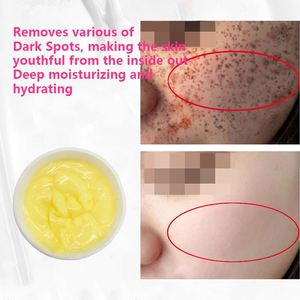 Crème pour le visage à l'alpha-arbutine contre les imperfections, vitamine C, crème anti-taches puissante, crème anti-pigmentation, crème contre les taches de rousseur et la texture de la peau - Product Image 2