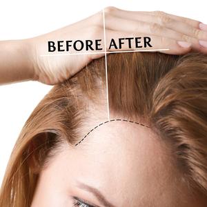 Aceite de Elilxir para el crecimiento del cabello, suero de tratamiento para la pérdida de cabello, aceite orgánico Natural, Etiqueta Privada - Product Image 4