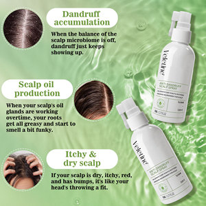 OEM/ODM Hair Silking Mist Cleansing Kopfhaut öl-Kontrolle Entfernen Sie Geruch Minze Anti Itchy Relief Kopfhaut Haar erfrischung <span class=keywords><strong>spray</strong></span> - Product Image 6