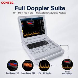 CONTEC CMS1700B Ecógrafo <span class=keywords><strong>Doppler</strong></span> Color para Ecocardiografía - Product Image 3