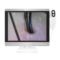 Meiboyi Détecteur de cuir chevelu à grand écran 15 pouces Dispositif d'analyse de la peau HD Caméra du cuir chevelu Diagnostic du cuir chevelu Salons de beauté
