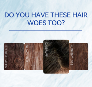 MOCHEQI <span class=keywords><strong>Shampoo</strong></span> Anticaduta Biologico di Alta Qualità a Prezzo di Fabbrica, Nutriente e <span class=keywords><strong>Antiforfora</strong></span> per <span class=keywords><strong>Capelli</strong></span> Ricci e <span class=keywords><strong>Grassi</strong></span> - Product Image 3