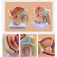 Humain 1:2 Mâle Pelvien Sagittal Section Testiculaire Prostate Vessie Rectale Système Urinaire Modèle Modèle Anatomie Reproductive