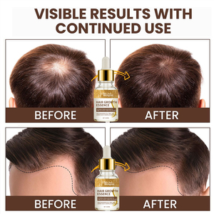 Suero de Tratamiento Capilar Vegano Orgánico Recomendado por Alibaba, con Queratina y <span class=keywords><strong>Aceite</strong></span> Esencial para Cabello Seco y Rizado, Nutre el Cabello - Product Image 3