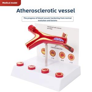 PVC kualitas tinggi model dokumenter pembuluh darah sains medis individual dan intrumen - Product Image 2