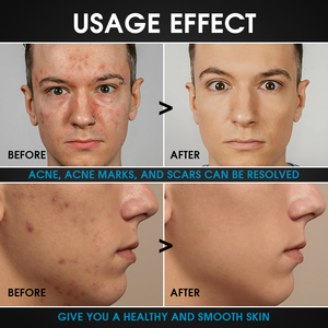 <span class=keywords><strong>Coffret</strong></span> de Soins <span class=keywords><strong>Visage</strong></span> <span class=keywords><strong>Homme</strong></span> Personnalisé Sans Sulfate Traitement Anti-Acné & Rafraîchissant à l'Hamamélis et au Théier <span class=keywords><strong>Coffret</strong></span> de Soins <span class=keywords><strong>pour</strong></span> Hommes Noirs - Product Image 5