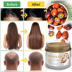 Huile de Batana personnalisée OEM avec logo privé pour la croissance des cheveux, 100% pure, naturelle, biologique, huile essentielle - Product Image 5