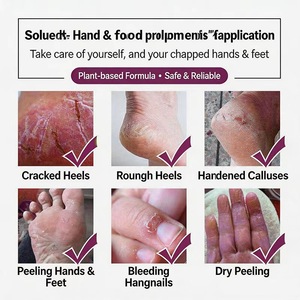 Crema Reparadora para Piel Agrietada |   Ungüento Hidratante y Reparador para Manos y Pies Agrietados - Product Image 5