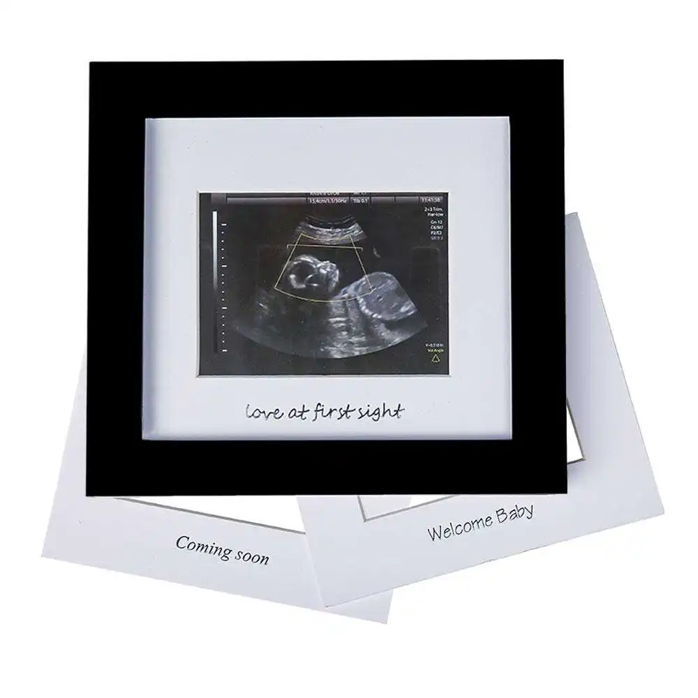 Grosir kustom bingkai foto Ultrasound hadiah bayi baru lahir Sonogram bingkai gambar Souvenir