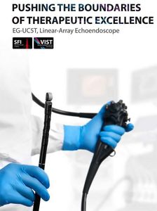 Échographe <span class=keywords><strong>endoscopique</strong></span> radial Sonoscape EUS 360, échographie <span class=keywords><strong>endoscopique</strong></span> 4D, équipement Sonoscape - Product Image 6
